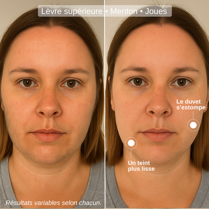 Huile de Souchet : Réduction naturelle de la pilosité