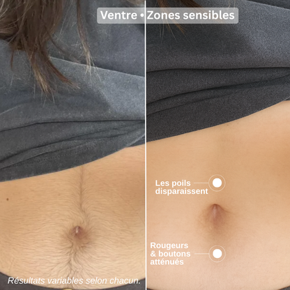 Huile de Souchet : Réduction naturelle de la pilosité