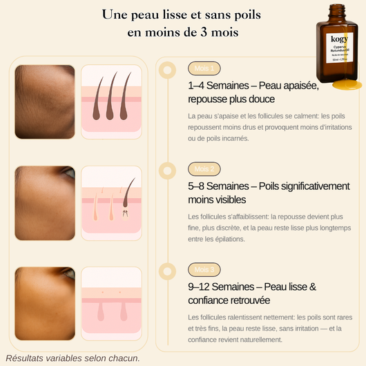 Huile de Souchet : Ralentit naturellement la repousse des poils