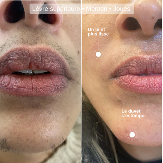 Huile de Souchet : Ralentit naturellement la repousse des poils